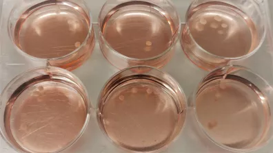 Organoïdes cérébraux dans des boîtes de Petri en laboratoire Organoïdes cérébraux dans des boîtes de Petri en laboratoire