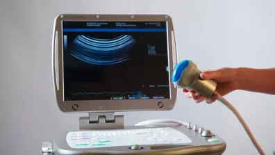 Modèle d'échographe Modèle d'échographe